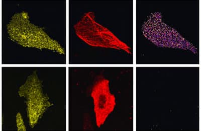 On the 2021 Nobel Prize and TRPV1 and PIEZO receptors